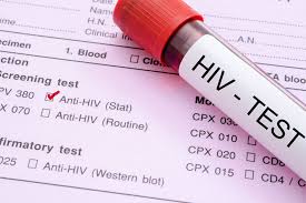 ಫೇಶಿಯಲ್ ಮಾಡಿಸಿಕೊಂಡ 3ಮಹಿಳೆಯರಲ್ಲಿ HIV ಪಾಸಿಟಿವ್